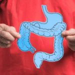 Rak jelita grubego - objawy i profilaktyka